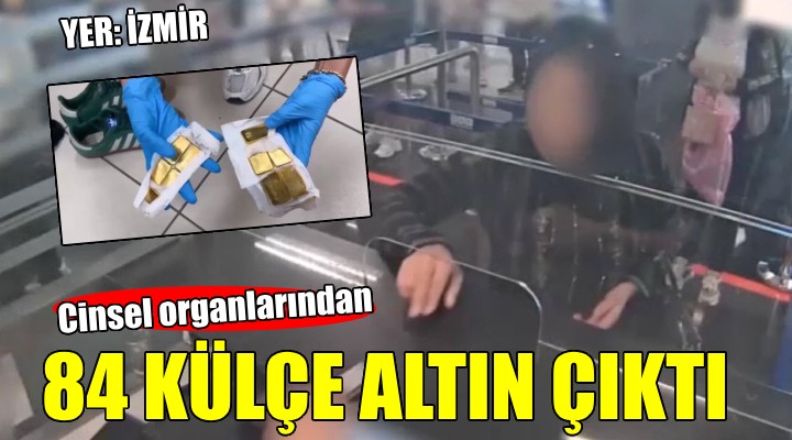 Cinsel organlarından 84 külçe altın çıktı...